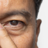 cataract-clinic