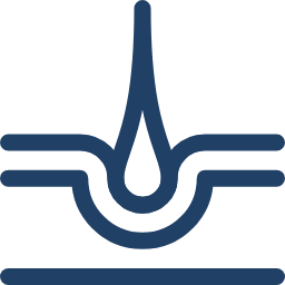 keratoconus